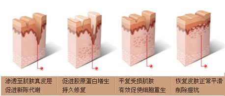 脸上的痘疤要如何处理